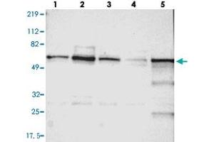 Western blot analysis of Lane 1: RT-4, Lane 2: U-251 MG, Lane 3: A-431, Lane 4: Liver, Lane 5: Tonsil with UPF3B polyclonal antibody  at 1:250-1:500 dilution. (UPF3B antibody)