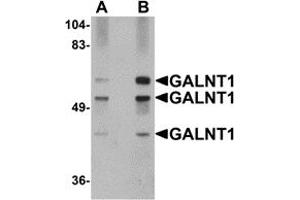 Western Blotting (WB) image for anti-UDP-N-Acetyl-alpha-D-Galactosamine:polypeptide N-Acetylgalactosaminyltransferase 10 (GalNAc-T10) (GALNT10) (N-Term) antibody (ABIN1031390)