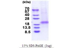 SDS-PAGE (SDS) image for XiAP Associated Factor 1 (XAF1) (AA 1-125) protein (His tag) (ABIN5853700) (XAF1 Protein (AA 1-125) (His tag))