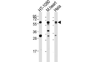 Western Blot at 1:2000 dilution Lane 1: HT-1080 whole cell lysates Lane 2: mouse heart lysates Lane 3: Hela whole cell lysates Lysates/proteins at 20 ug per lane.