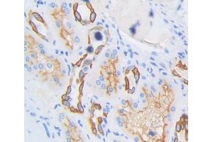 #VALUE! (SPTLC3 antibody  (AA 238-552))