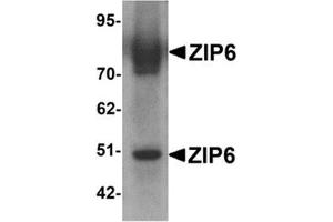 Western blot analysis of ZIP6 in mouse lung tissue lysate with ZIP6 antibody at 1 μg/ml. (SLC39A6 antibody  (Center))