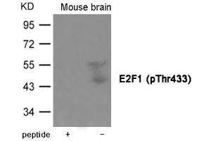 Western blot analysis of extracts from Mouse brain tissue using E2F1 (Phospho-Thr433) Antibody. (E2F1 antibody  (pThr433))