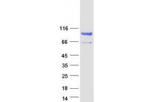 Validation with Western Blot (FAM22G Protein (Transcript Variant 2) (Myc-DYKDDDDK Tag))