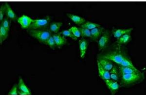 Immunofluorescent analysis of Hela cells using ABIN7160604 at dilution of 1:100 and Alexa Fluor 488-congugated AffiniPure Goat Anti-Rabbit IgG(H+L) (MYBPC2 antibody  (AA 739-1141))