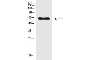 Western Blot analysis of Hela cells using Phospho-Vimentin (Tyr38) Polyclonal Antibody at dilution of 1:500. (Vimentin antibody  (pTyr38))
