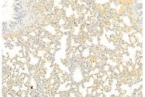 ABIN6261472 and ABIN6269092 at 1/100 staining Rat lung tissue by IHC-P. (EIF2A antibody  (N-Term))