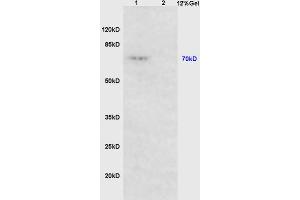 Lane 1:rat heart lysates Lane 2: human myeloma cell(S/P20) lysates probed with Anti PTPN6/SHP1 Polyclonal Antibody, Unconjugated  at 1:3000 90min in 37˚C. (SHP1 antibody  (AA 501-595))