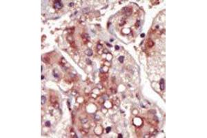 Image no. 1 for anti-Mitogen-Activated Protein Kinase Kinase 2 (MAP2K2) (Middle Region) antibody (ABIN360373)