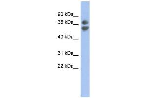 PDCD7 antibody used at 1 ug/ml to detect target protein.