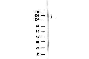 Western blot analysis of lysates from 293 cells(LPS 4h treatment), using Phospho-JAK1 (Tyr1034/Tyr1035) Antibody at 1/1000 dilution.