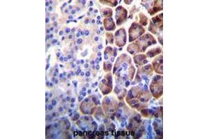 COPE Antibody (C-term) immunohistochemistry analysis in formalin fixed and paraffin embedded human pancreas tissue followed by peroxidase conjugation of the secondary antibody and DAB staining. (COPE antibody  (C-Term))