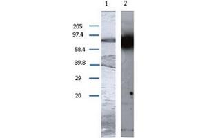 Western Blot using TGM1 antibody. (TGM1 antibody)