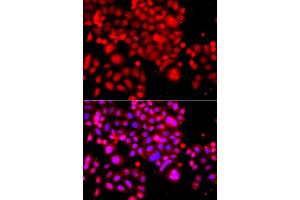 Immunofluorescence analysis of A549 cells using ASCC3 antibody (ABIN5974947).