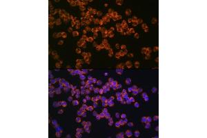 Immunofluorescence analysis of K562 cells using CD127/IL7R Rabbit mAb (ABIN7268005) at dilution of 1:100 (40x lens). (IL7R antibody)