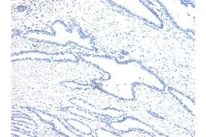 (ABIN6391406) Negative Control showing staining of paraffin embedded Human Prostate, with no primary antibody. (Homeobox D13 antibody  (Internal Region))