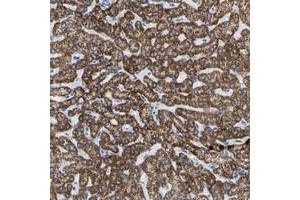 Immunohistochemical staining of human liver with ZNF629 polyclonal antibody  shows strong cytoplasmic positivity in hepatocytes at 1:50-1:200 dilution.