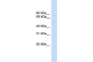 WB Suggested Anti-ZNF483 Antibody Titration:  0. (ZNF483 antibody  (Middle Region))