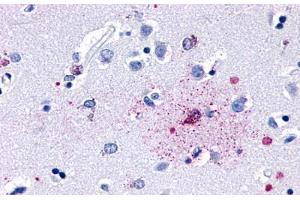 GPR139 antibody  (Cytoplasmic Domain)