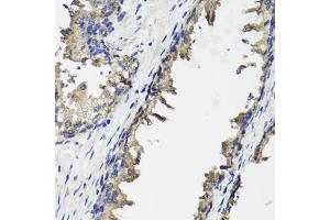 Immunohistochemistry of paraffin-embedded human prostate using OTC antibody. (OTC antibody)