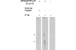 Image no. 1 for anti-Arachidonate 5-Lipoxygenase-Activating Protein (ALOX5AP) antibody (ABIN4620366) (ALOX5AP antibody)