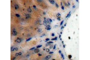 Used in DAB staining on fromalin fixed paraffin-embedded Liver tissue (IL1RN antibody  (AA 26-177))