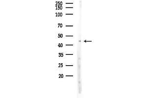 Western blot analysis of lysates from HepG2 cells(heat-shock,45 min treatment), using DKK3 Antibody at 1/1000 dilution.
