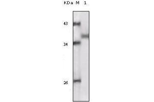 Western blot analysis using RSK1 mouse mAb against truncated RSK1 recombinant protein. (RPS6KA1 antibody)