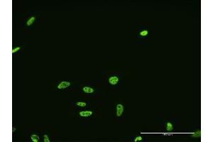 Immunofluorescence of monoclonal antibody to FUSIP1 on HeLa cell. (SRSF10 antibody  (AA 1-100))