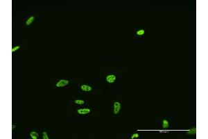 Immunofluorescence of monoclonal antibody to FUSIP1 on HeLa cell.