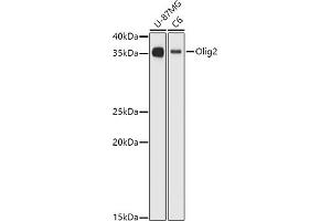 Western blot analysis of extracts of various cell lines, using Olig2 antibody (ABIN6128396, ABIN6145015, ABIN6145016 and ABIN6216575) at 1:1000 dilution. (OLIG2 antibody  (AA 1-80))