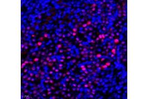 Immunofluorescence of paraffin embedded mouse kidney using Transketolase (ABIN7075978) at dilution of 1: 1100 (400x lens) (TKT antibody)
