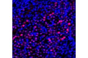 Immunofluorescence of paraffin embedded mouse kidney using Transketolase (ABIN7075978) at dilution of 1: 1100 (400x lens) (TKT antibody)