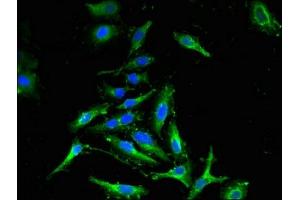 Immunofluorescent analysis of Hela cells using ABIN7148889 at dilution of 1:100 and Alexa Fluor 488-congugated AffiniPure Goat Anti-Rabbit IgG(H+L)