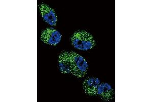 Confocal immunofluorescent analysis of CYP4A11 (4A22) Antibody (C-term) (ABIN392368 and ABIN2842004) with NCI- cell followed by Alexa Fluor 488-conjugated goat anti-rabbit lgG (green). (CYP4A11+22 (AA 407-435), (C-Term) antibody)