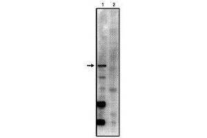 Image no. 1 for anti-Protein Phosphatase 2, Regulatory Subunit B', gamma (PPP2R5C) (AA 53-66) antibody (ABIN264946) (PPP2R5C antibody  (AA 53-66))