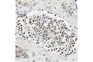 Immunohistochemical staining (Formalin-fixed paraffin-embedded sections) of human testis with MYST4 polyclonal antibody  shows strong nuclear positivity in cells in seminiferous ducts.