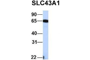 Host:  Rabbit  Target Name:  FAM46C  Sample Type:  Human Fetal Liver  Antibody Dilution:  1. (SLC43A1 antibody  (Middle Region))