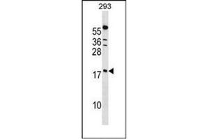 Western blot analysis of PPIL1 Antibody (Center) in 293 cell line lysates (35ug/lane). (PPIL1 antibody  (Middle Region))