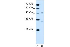 WB Suggested Anti-CHST1 Antibody Titration:  1. (CHST1 antibody  (N-Term))