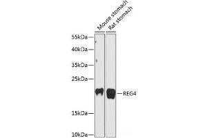 Western blot analysis of extracts of various cell lines using REG4 Polyclonal Antibody at dilution of 1:3000. (REG4 antibody)