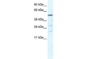 WB Suggested Anti-HSFY1 Antibody Titration:  5. (HSFY1 antibody  (N-Term))