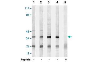 Western blot analysis of extracts from HepG2 cells (Lane 1), Jurkat cells (Lane 2), COLO cells (Lane 3) and HUVEC cells (Lane 4 and lane 5), using B3GALT1 polyclonal antibody .