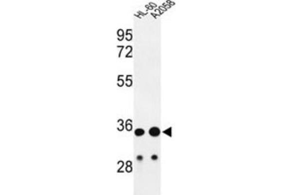 IgH antibody