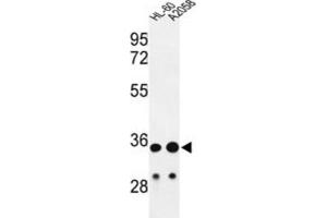 Western Blotting (WB) image for anti-Immunoglobulin Heavy Chain (IgH) antibody (ABIN2995207) (IgH antibody)