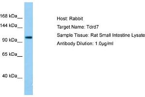 Host: RabbitTarget Name: Tdrd7Antibody Dilution: 1. (TDRD7 antibody  (C-Term))