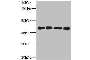Western blot All lanes: MAGEB18 antibody at 12 μg/mL Lane 1: MCF-7 whole cell lysate Lane 2: A549 whole cell lysate Lane 3: Hela whole cell lysate Lane 4: Mouse heart tissue Secondary Goat polyclonal to rabbit IgG at 1/10000 dilution Predicted band size: 39 kDa Observed band size: 39 kDa