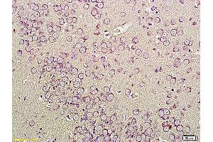 Formalin-fixed and paraffin embedded human cervical tissue labeled with Anti-CNR1 Polyclonal Antibody, Unconjugated (ABIN732923) at 1:200, followed by conjugation to the secondary antibody and DAB staining (CNR1 antibody  (AA 401-472))