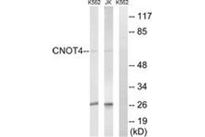 Western blot analysis of extracts from Jurkat/K562 cells, using CNOT4 Antibody. (CNOT4 antibody  (AA 61-110))
