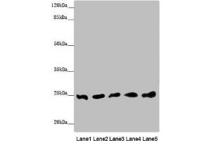 Western blot All lanes: EEF1B2 antibody at 0. (EEF1B2 antibody  (AA 1-225))